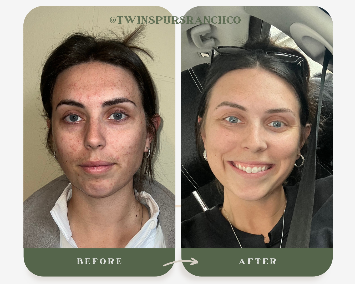 Unscented Tallow Facial Moisturizer