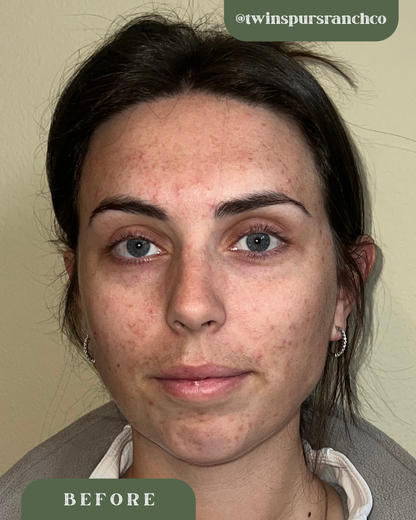 Natural Tallow Skincare Routine Bundle